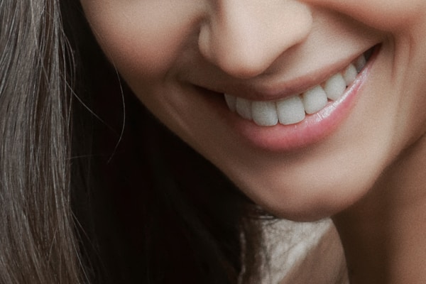 Early caries management protocol